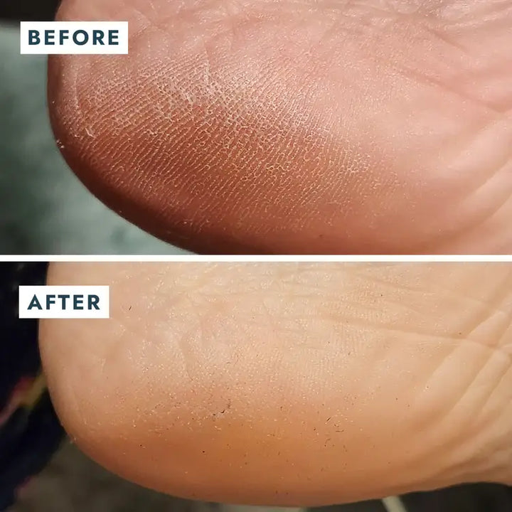 Solemate Heel Repair Balm Retail - Lavender